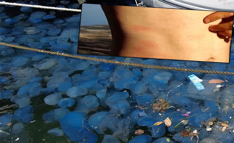 Foça'da denizanası istilasının ardından vakalar arttı