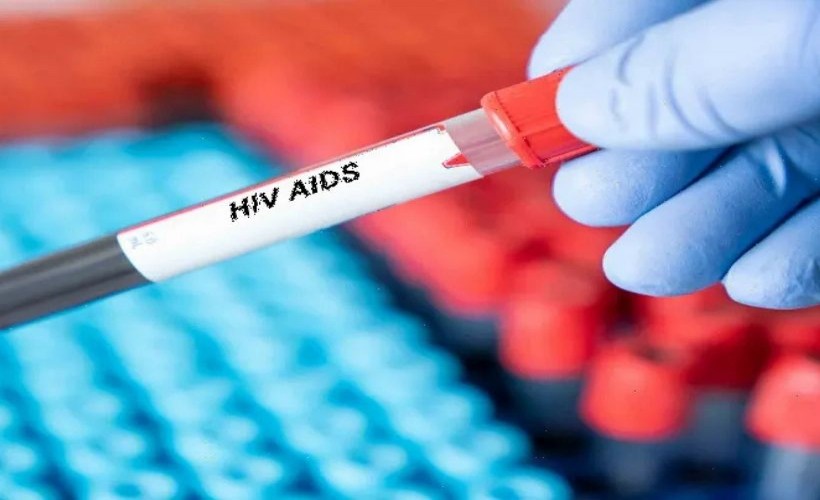 İzmir Tabip Odası'dan 'AIDS'ten ölen çocuğa ilişkin çağrı: Kuşku ortadan kaldırılmalı