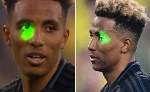 Fernandes'in gözüne lazer tutan seyirci gözaltına alındı