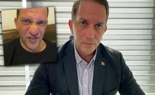 AK Parti'li Mücahit Birinci'den bir skandal çıkış daha!