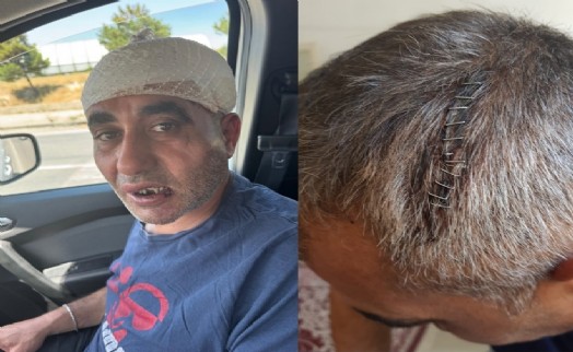 Eğlence mekanında darbedildiği iddiasıyla şikayetçi oldu