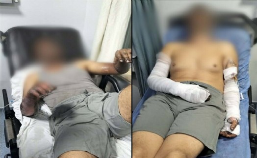 Oto tamirhanesinde patlama; 2 işçi yaralandı