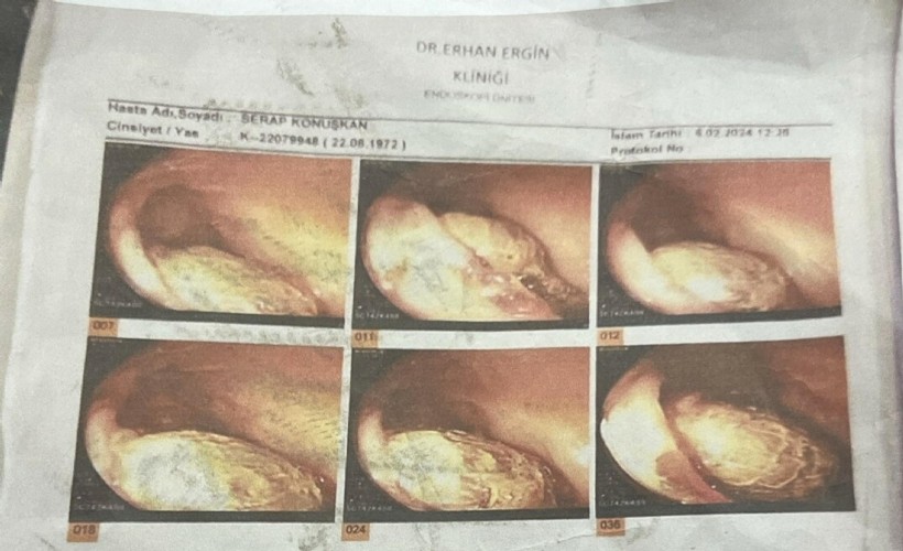 Ameliyatta gazlı bez unutulduğu iddiasıyla 2 doktor hakkında dava