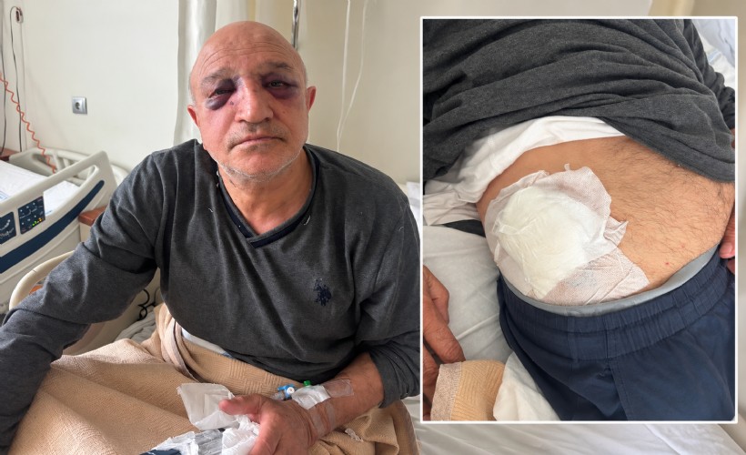 İzmir'de oda başkanına evinin önünde silahlı ve bıçaklı saldırı
