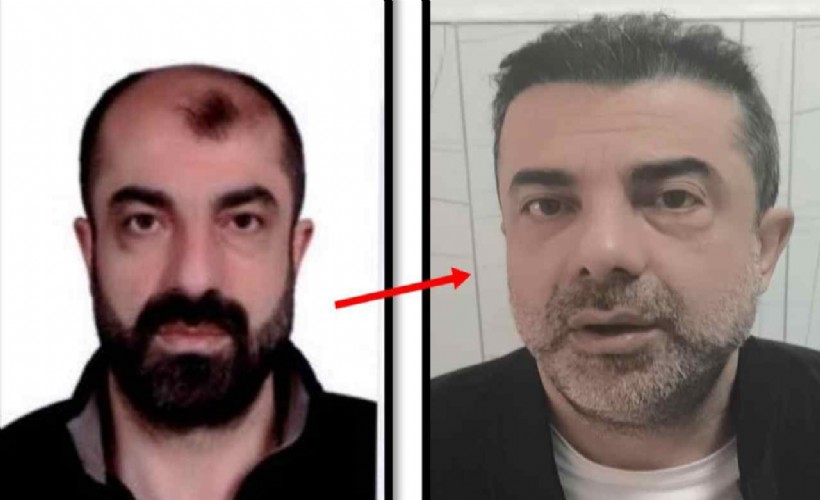 Filmleri aratmayan olay! Ameliyatla yüzünü değiştiren cinayet zanlısı 7 yıl sonra yakalandı