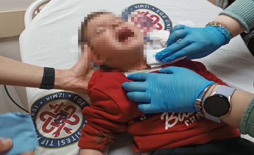 Parkta oynayan çocuğu bıçakla yaralayan saldırgan tutuklandı