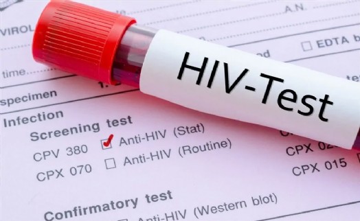 Büyükşehir'den ikinci Gönüllü Danışmanlık ve Test Merkezi