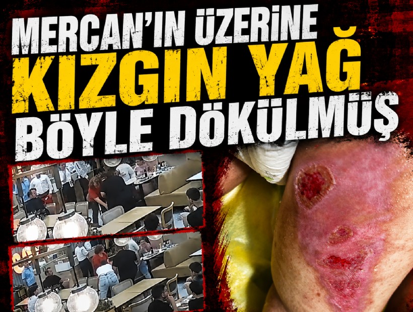 Kızgın tereyağının Mercan'ın üzerine döküldüğü anların görüntüsü ortaya çıktı