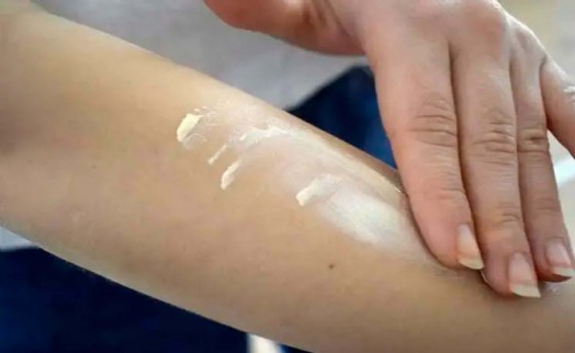 Uzmanlardan uyarı: Güneş kremi ve gözlük aksesuar değil, sağlık ihtiyacı