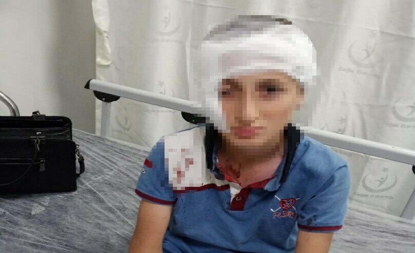 Mahkeme kalıcı izi dikkate aldı: Köpek sahibine 1 milyon 200 bin TL tazminat