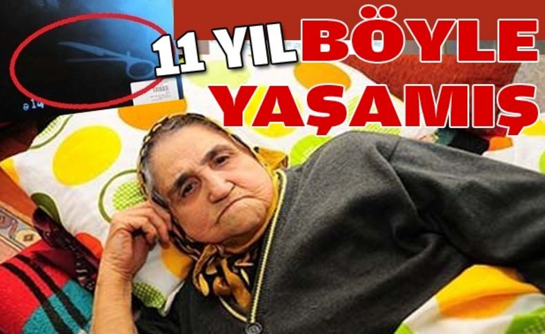 11 yıl karnında kırık makasla yaşamış