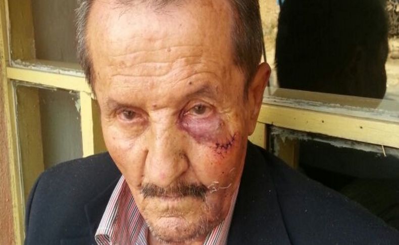70 yaşındaki engelli vatandaşı 50 lira için darp ettiler