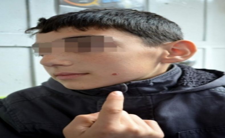Harçlığını almaya kalkıştığı öğrencinin yanağında sigara söndürdü