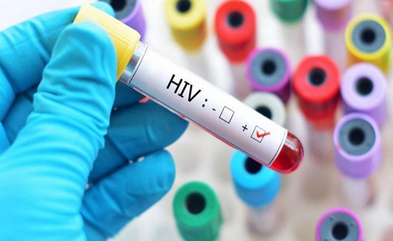 HIV virüsü taşıyanların yüzde 75'i durumundan haberdar