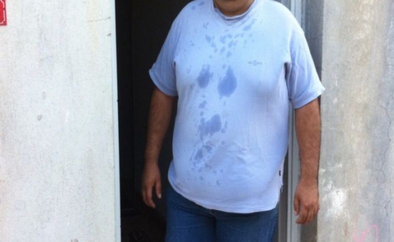 Kadirlili 180 kiloluk obezite hastası tedavi olmak istiyor